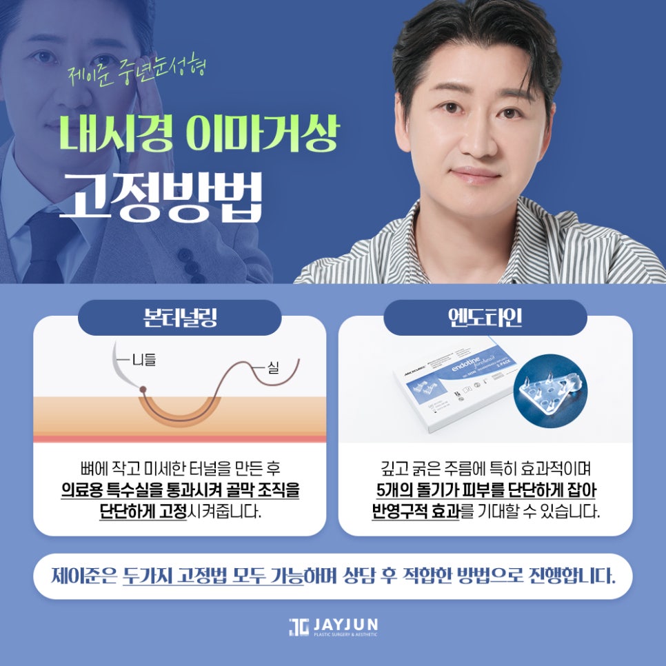 [제이준 성형외과] 이마 주름과 처진 눈매 개선에는! 제이준 중년눈성형 내시경 이마거상 관련 이미지 5