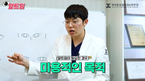 [Jaejune Plastic Surgery & Dermatology] Why is epicanthoplasty necessary? Everything about epicanthoplasty!! image 16
