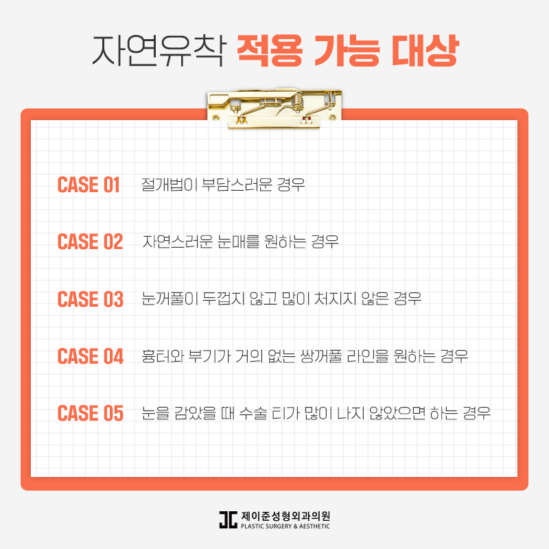 자연스러운 라인을 위한 자연유착 관련 이미지 3