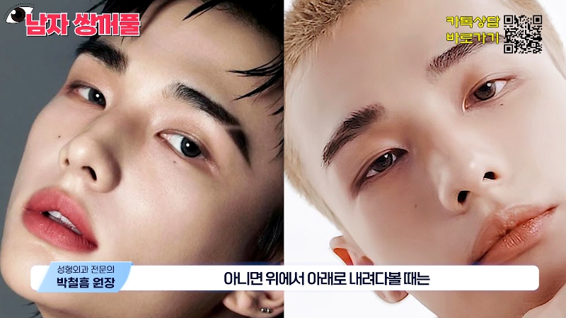 [Jeijun Plastic Surgery & Dermatology] Types and Features of Men’s Double Eyelid Lines Seen Through Celebrities! image 6