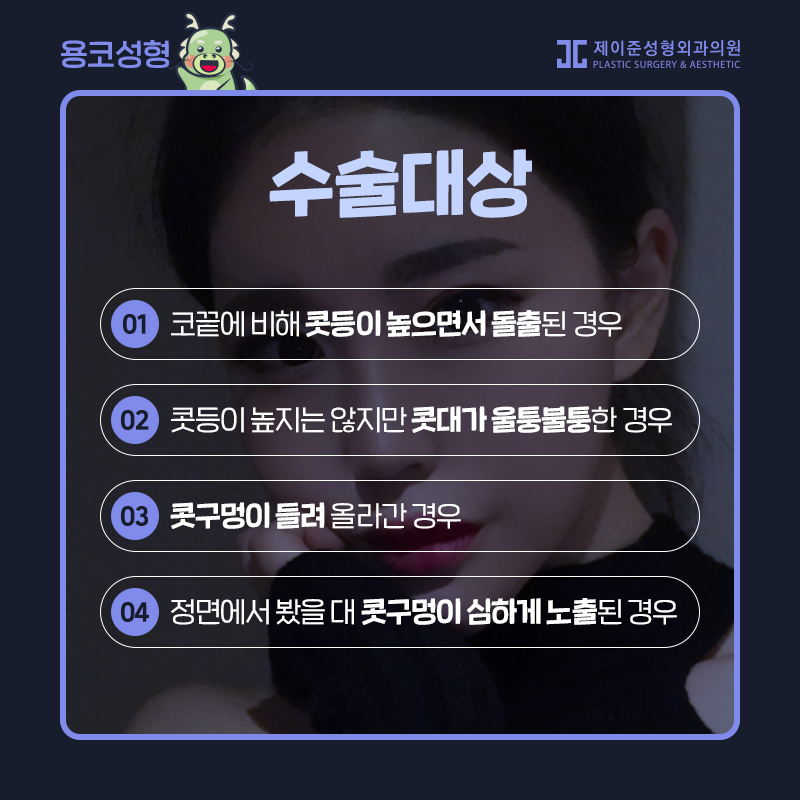 용코성형 찾으신다면? 관련 이미지 3