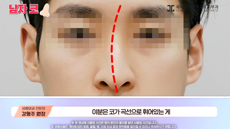 [제이준성형외과&middot;피부과] 남자 인상의 결정적인 부위 관련 이미지 23