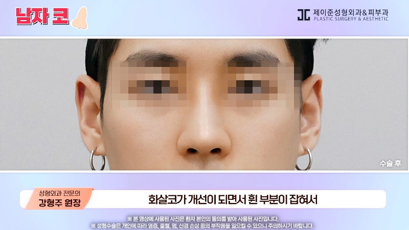 [제이준성형외과&middot;피부과] 남자 인상의 결정적인 부위 관련 이미지 26