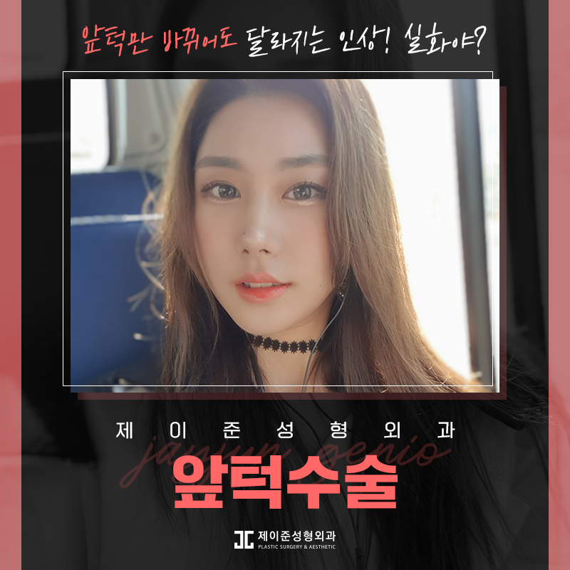 갸름한 얼굴형을 위한 앞턱수술 관련 이미지 1