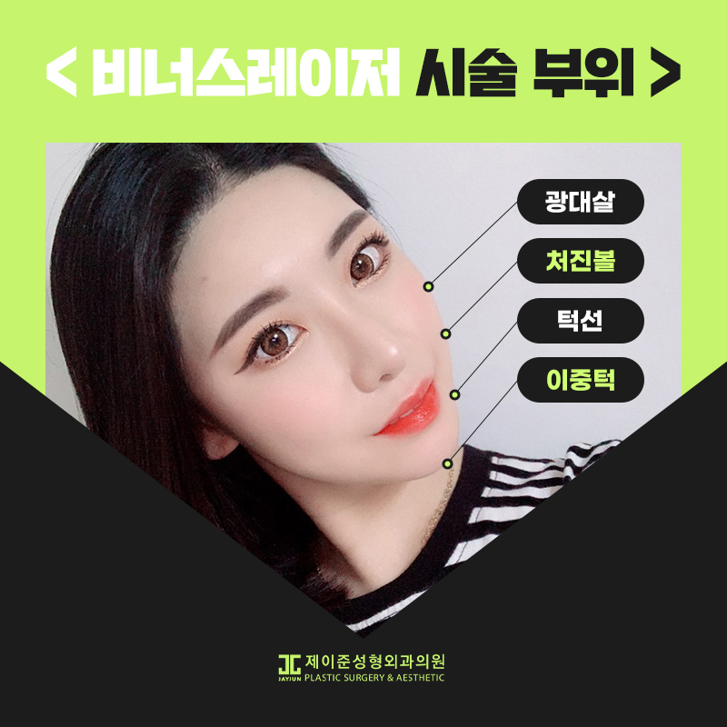 비너스레이저 알아보기 관련 이미지 3