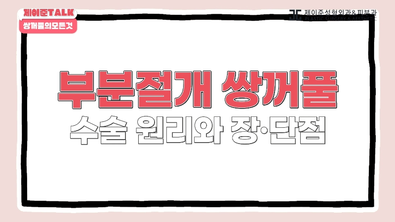[제이준성형외과&middot;피부과] 비절개&middot;부분절개&middot;절개 쌍꺼풀의 원리와 차이점! 관련 이미지 10