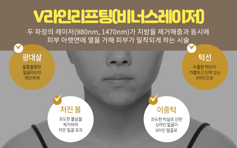 제이준성형외과│이중턱을 제거하고  이별하는 방법! (+V라인레이저) 관련 이미지 6