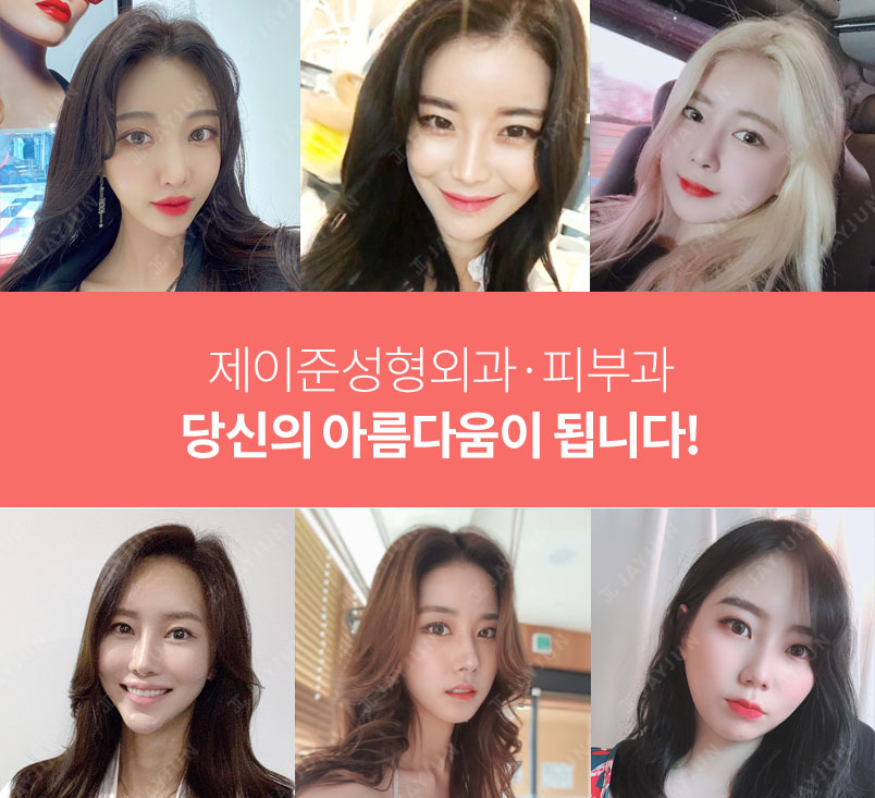제이준피부과, 강남 입술필러 용량이 무제한이라고?! 관련 이미지 8