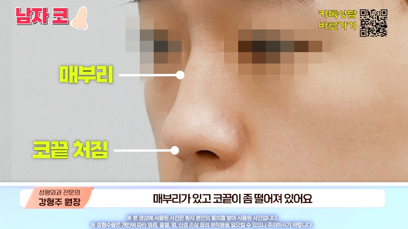 [제이준성형외과&middot;피부과] 남자 인상의 결정적인 부위 관련 이미지 18
