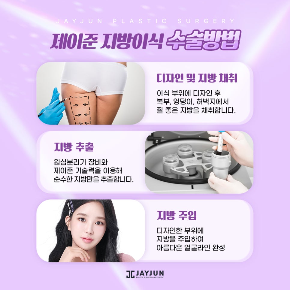 [강남 제이준] 고급스러운 얼굴라인 - 지방이식편 관련 이미지 3