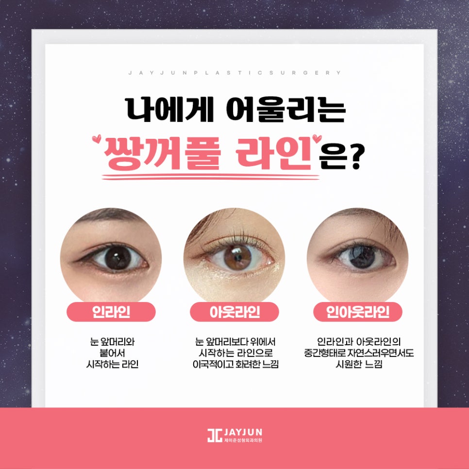 [제이준성형외과&middot;피부과] 내 눈에 찰떡인 쌍꺼풀 라인! 미리 찾아보기👀 관련 이미지 11