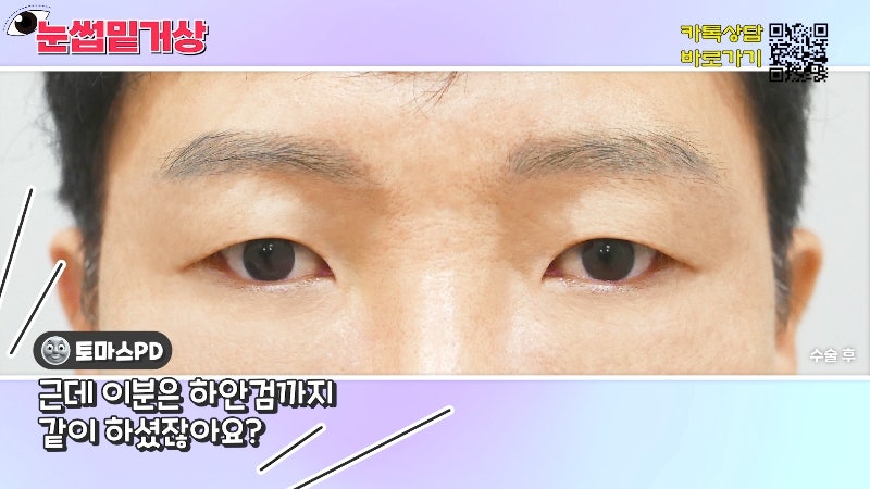 [Jayjun Plastic Surgery & Dermatology] Worried about drooping eyelids? Solve sagging eyes with a brow lift under the eyebrows without double eyelid surgery! image 20