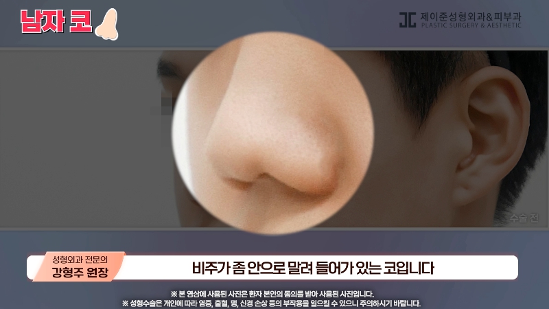 [제이준성형외과&middot;피부과] 남자 인상의 결정적인 부위 관련 이미지 11