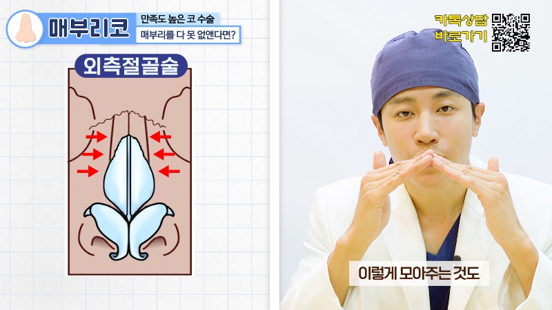 [제이준 유튜브] 유형별 코 성형, 가장 만족도 큰 매부리 코! 관련 이미지 15