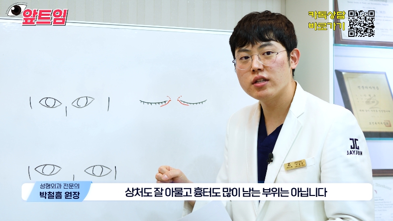[Jaejune Plastic Surgery & Dermatology] Why is epicanthoplasty necessary? Everything about epicanthoplasty!! image 29