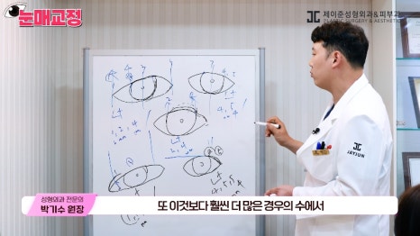 [제이준성형외과&middot;피부과] 눈매교정 파헤치기! 하나부터 열까지 싹~ 알려드립니다! 관련 이미지 13