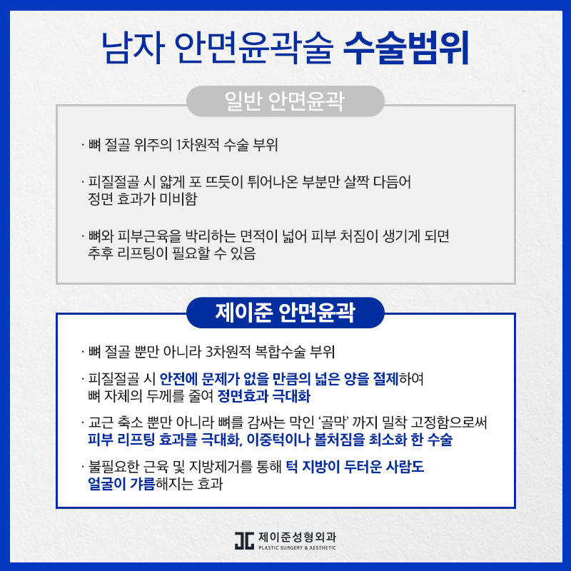 남자안면윤곽술, 부드럽고 샤프한 인상으로! 관련 이미지 6