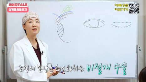 [제이준성형외과&middot;피부과] 비절개&middot;부분절개&middot;절개 쌍꺼풀의 원리와 차이점! 관련 이미지 6