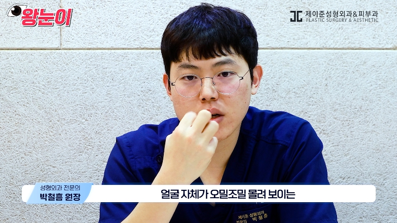 [제이준성형외과&middot;피부과] 제이준성형외과 박철흠 원장님이 알려주는 눈이 커지는 방법 핵심요약! 관련 이미지 33