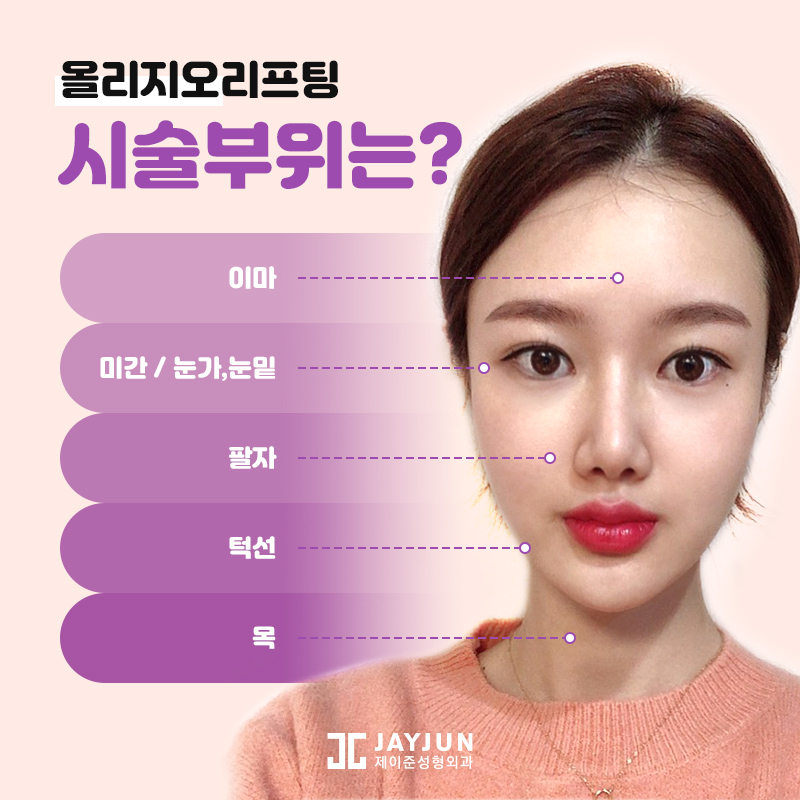 레이저리프팅! 울쎄라, 써마지, 올리지오 알아보기 관련 이미지 10