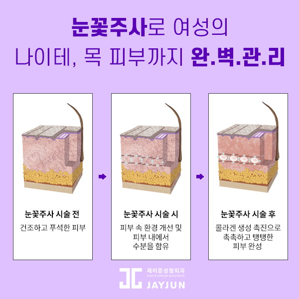 제이준성형외과-피부과｜수분팡팡 관련 이미지 2