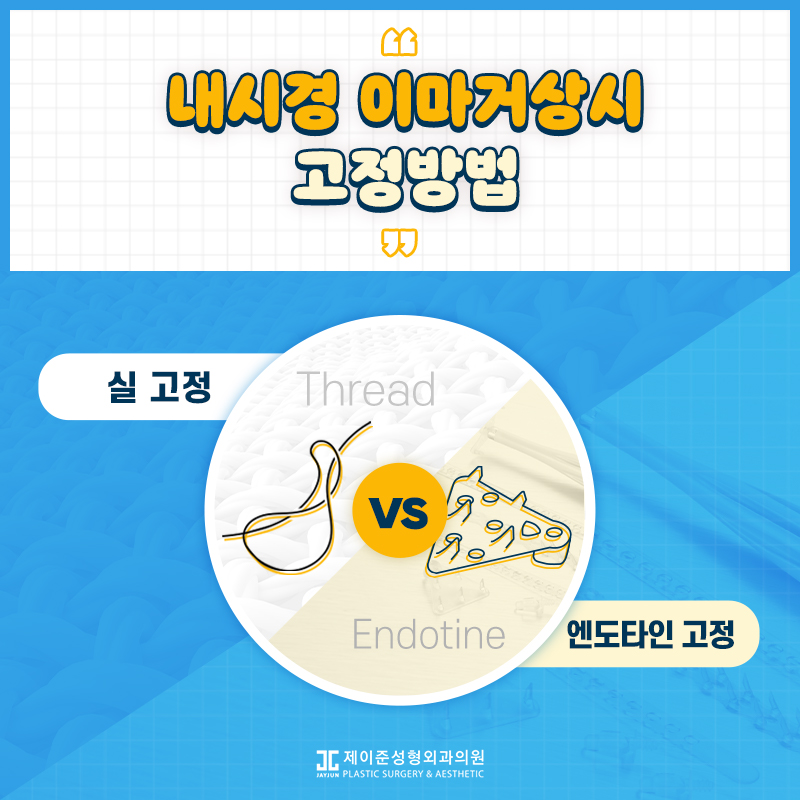 [강남눈성형] 눈성형하러갔는데 이마거상 추천하는 이유 관련 이미지 7