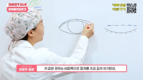 [제이준성형외과&middot;피부과] 비절개&middot;부분절개&middot;절개 쌍꺼풀의 원리와 차이점! 관련 이미지 12