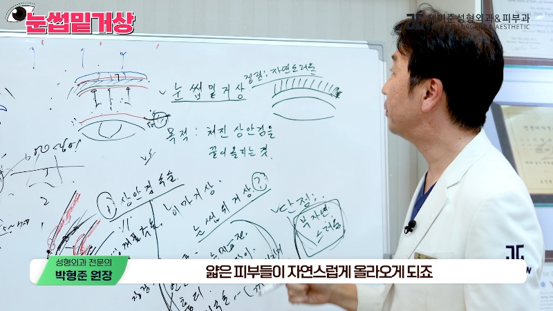 [제이준성형외과&middot;피부과] 쌍꺼풀 라인 변화 없이 눈매 개선은 확실하게! #눈썹밑거상 관련 이미지 14