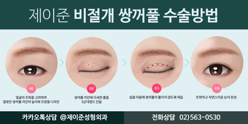 [제이준성형외과] 강남역 쌍수,  자연스러운 변화를 얻으려면? 관련 이미지 3