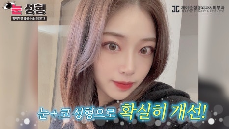 [제이준 유튜브] 눈 성형, 함께 하면 효과 좋은 수술 BEST 3! 관련 이미지 8