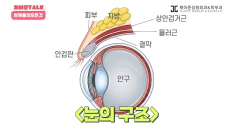 [제이준성형외과&middot;피부과] 비절개&middot;부분절개&middot;절개 쌍꺼풀의 원리와 차이점! 관련 이미지 2