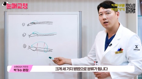 [제이준성형외과&middot;피부과] 눈매교정 파헤치기! 하나부터 열까지 싹~ 알려드립니다! 관련 이미지 8