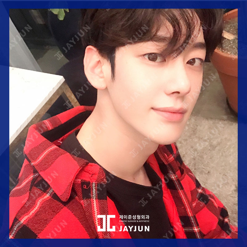 강남 남자코성형, 제이준성형외과의 접근방식은 달라! 관련 이미지 5