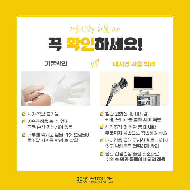 가슴확대술 어떤 수술일까요? 관련 이미지 4