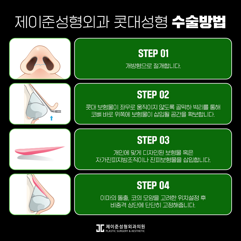 콧대성형 잘하는곳 찾는다면? 관련 이미지 4