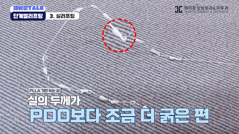 [제이준성형외과&middot;피부과] 보톡스부터 안면거상까지, 내 처짐 수준에 맞는 리프팅 선택법 관련 이미지 16