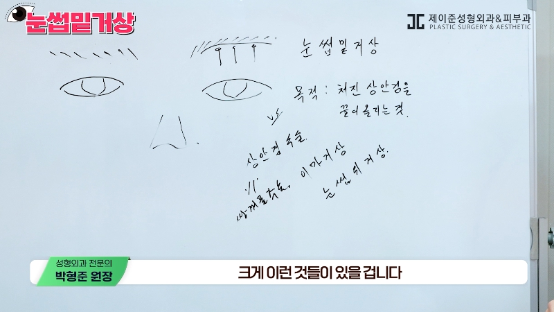 [제이준성형외과&middot;피부과] 쌍꺼풀 라인 변화 없이 눈매 개선은 확실하게! #눈썹밑거상 관련 이미지 6