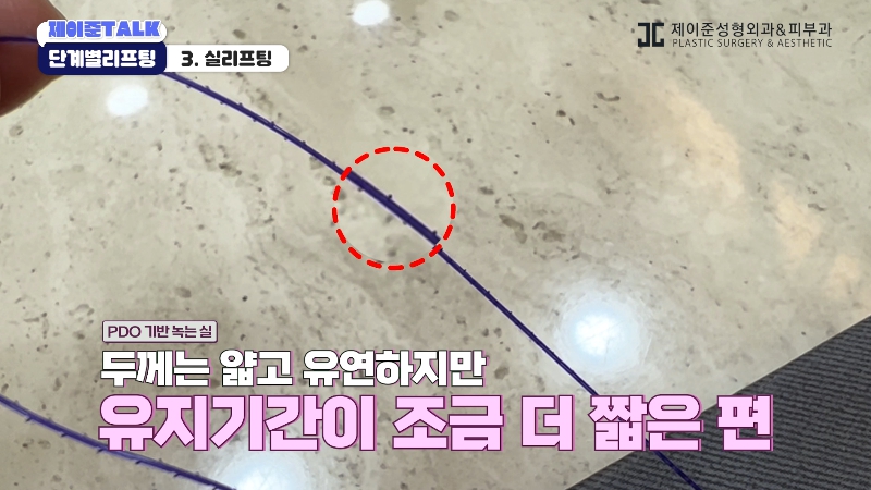 [제이준성형외과&middot;피부과] 보톡스부터 안면거상까지, 내 처짐 수준에 맞는 리프팅 선택법 관련 이미지 17