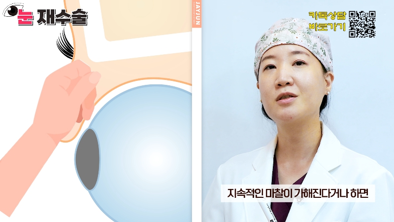[Jeijun Plastic Surgery &amp; Dermatology] Everything a plastic surgery specialist wants you to know about eyelid revision surgery! Customized methods by case! image 6