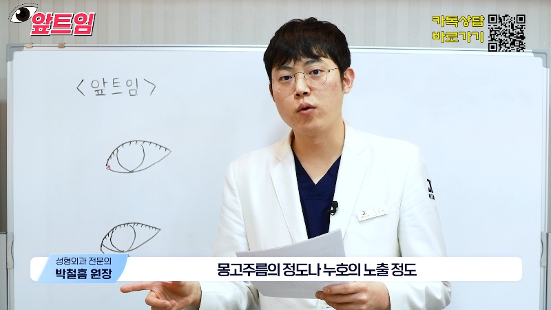 [Jaejune Plastic Surgery & Dermatology] Why is epicanthoplasty necessary? Everything about epicanthoplasty!! image 6