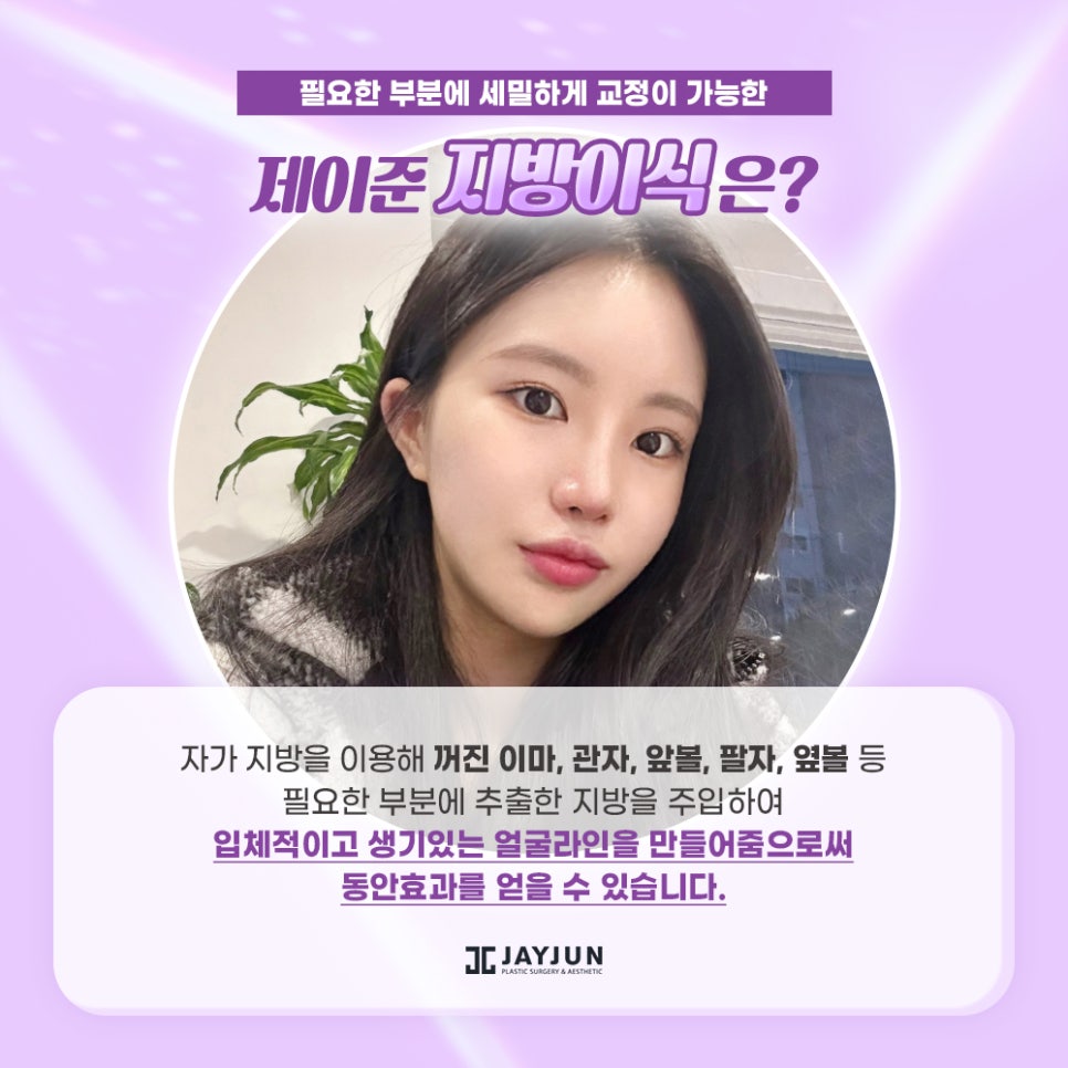 [강남 제이준] 고급스러운 얼굴라인 - 지방이식편 관련 이미지 2