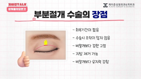[제이준성형외과&middot;피부과] 비절개&middot;부분절개&middot;절개 쌍꺼풀의 원리와 차이점! 관련 이미지 15