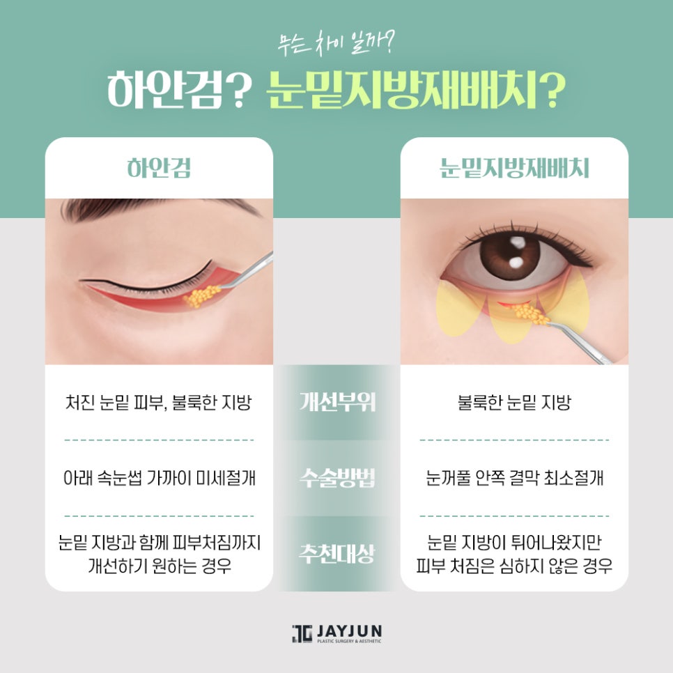 [제이준성형외과] 매끈하고 탄력있는 눈 밑으로! 중년눈성형 하안검 관련 이미지 4