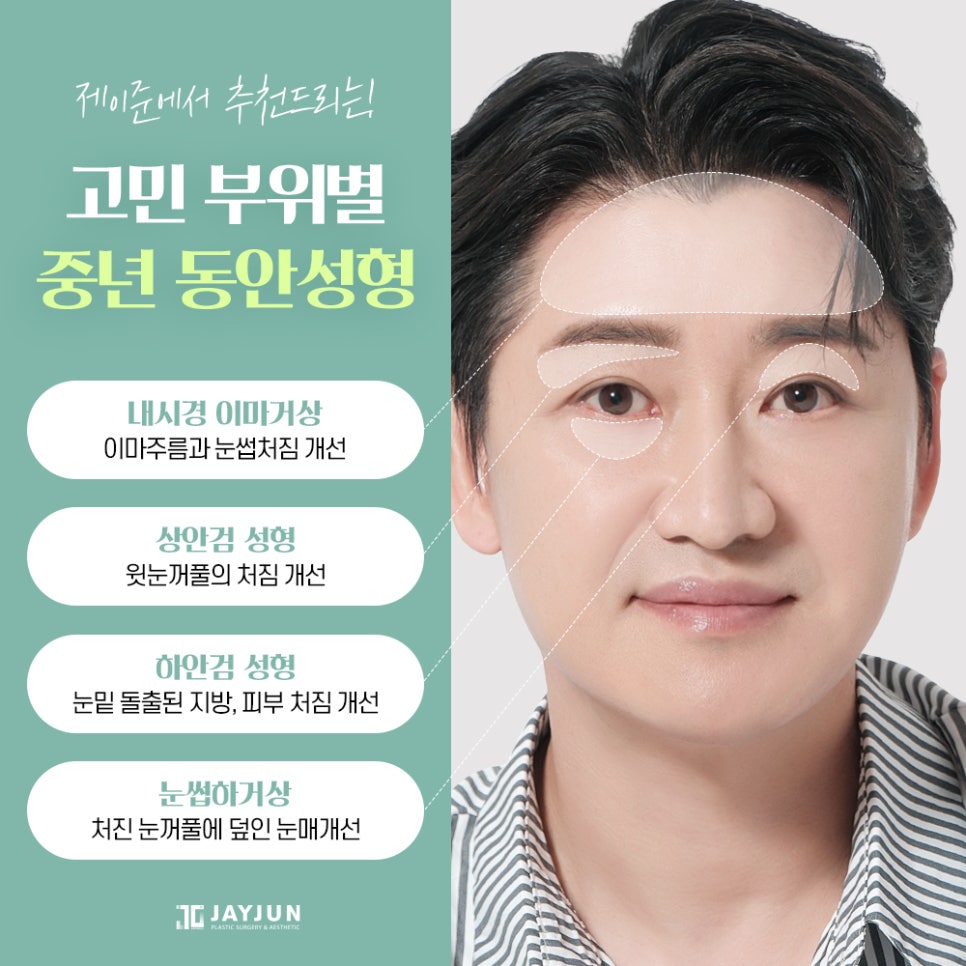 [제이준성형외과] 매끈하고 탄력있는 눈 밑으로! 중년눈성형 하안검 관련 이미지 8