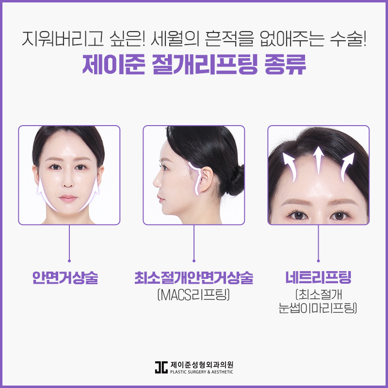 동안으로 거듭나는 안면거상술 관련 이미지 6