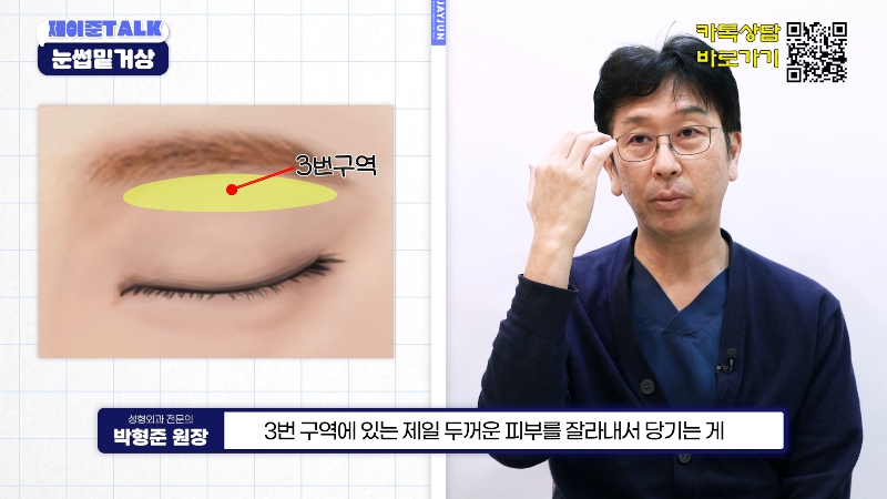 [Jaejune Plastic Surgery & Dermatology] The Secret to a Cleaner Eye Area Without Looking Obvious. #BrowboneLift image 6