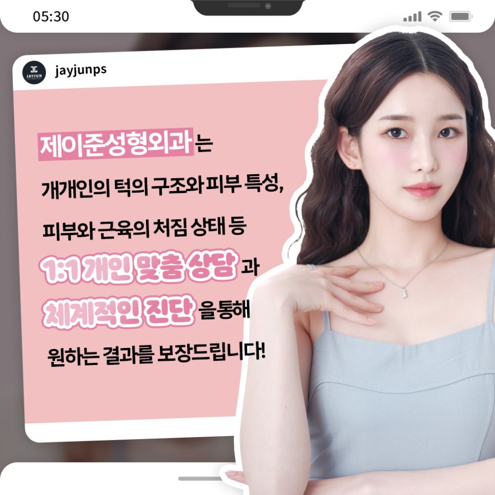 한번에 확실하게! 제이준 이중턱 지방흡입 & 근육묶기 관련 이미지 10