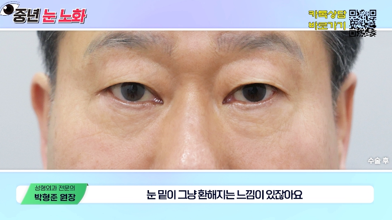 [제이준성형외과&middot;피부과] 🚨성형외과 전문의가 알려주는 눈 노화 신호🚨 관련 이미지 21