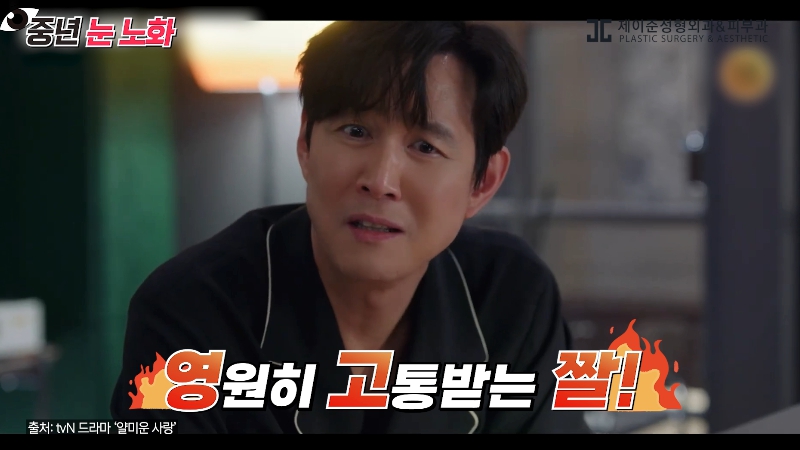 [제이준성형외과&middot;피부과] 🚨성형외과 전문의가 알려주는 눈 노화 신호🚨 관련 이미지 7