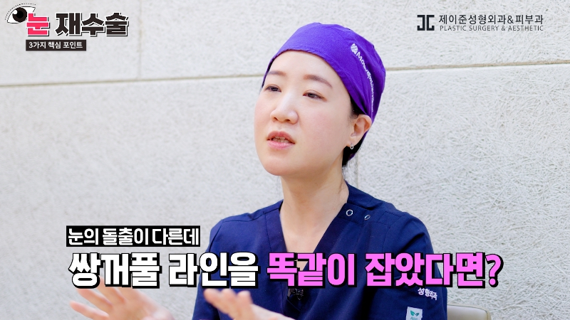 [제이준 유튜브] 눈 재수술을 막기위한 3가지 포인트! 관련 이미지 10